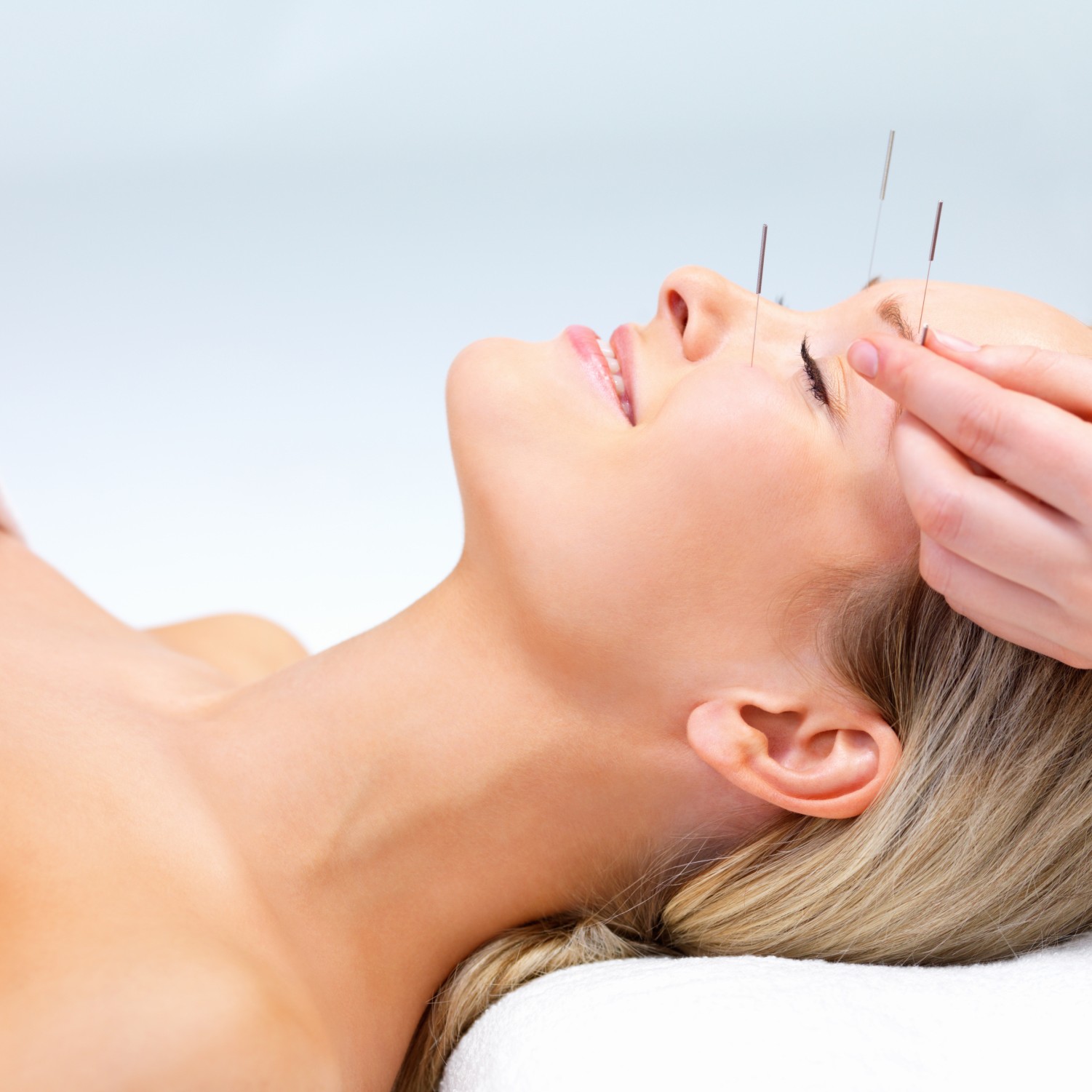 Beautiful young woman with eyes closed receiving Acupuncture therapy